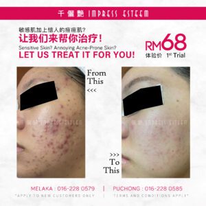 价值 #RM68的初次脸部护肤护理体验价! FIRST trial facial treatment experience price worth #onlyRM68!