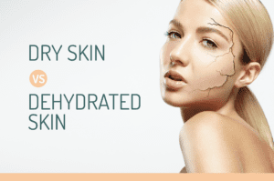 The differences of Dry Skin and Dehydrated Skin！干性皮肤和缺水性的区别！